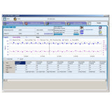 SpectrO2 Logix® Clinical Analysis Software