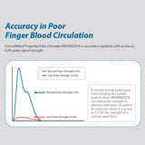 MD300CI216 - Poor Circulation Graph