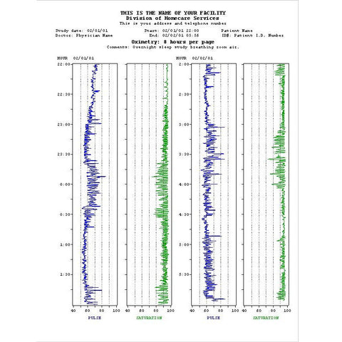 Profox Oximetry Software for Sleep Studies - Digital Download with 1 u ...