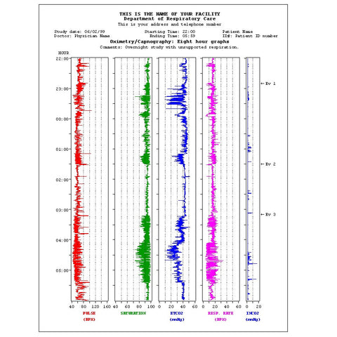 PROFOX 8 hour graphic report